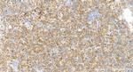 IL3RA/CD123 Antibody in Immunohistochemistry (Paraffin) (IHC (P))