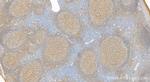 IL3RA/CD123 Antibody in Immunohistochemistry (Paraffin) (IHC (P))
