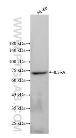 IL3RA/CD123 Antibody in Western Blot (WB)