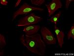 CBX1 Antibody in Immunocytochemistry (ICC/IF)