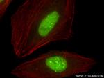 CBX1 Antibody in Immunocytochemistry (ICC/IF)