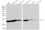 CBX1 Antibody in Western Blot (WB)