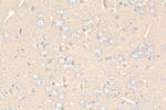 SNAP25 Antibody in Immunohistochemistry (Paraffin) (IHC (P))