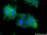 SNAP25 Antibody in Immunocytochemistry (ICC/IF)