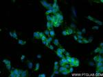 SNAP25 Antibody in Immunocytochemistry (ICC/IF)