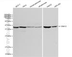 GNA12 Antibody in Western Blot (WB)