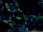 EFHD2 Antibody in Immunocytochemistry (ICC/IF)