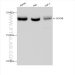 DOCK8 Antibody in Western Blot (WB)