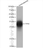 TFPI2 Antibody in Western Blot (WB)