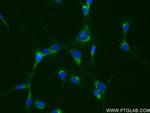 Shh Antibody in Immunocytochemistry (ICC/IF)