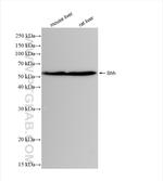 Shh Antibody in Western Blot (WB)