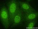 NUP85 Antibody in Immunocytochemistry (ICC/IF)
