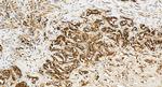 ECSIT Antibody in Immunohistochemistry (Paraffin) (IHC (P))
