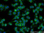 CD14 Antibody in Immunocytochemistry (ICC/IF)