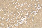 STX1B Antibody in Immunohistochemistry (Paraffin) (IHC (P))