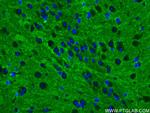 STX1B Antibody in Immunohistochemistry (PFA fixed) (IHC (PFA))