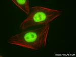 SMARCA4 Antibody in Immunocytochemistry (ICC/IF)