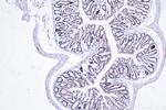 SMARCA4 Antibody in Immunohistochemistry (Paraffin) (IHC (P))
