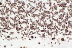 SMARCA4 Antibody in Immunohistochemistry (Paraffin) (IHC (P))