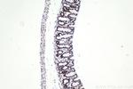 SMARCA4 Antibody in Immunohistochemistry (Paraffin) (IHC (P))