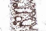 SMARCA4 Antibody in Immunohistochemistry (Paraffin) (IHC (P))