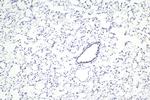 SMARCA4 Antibody in Immunohistochemistry (Paraffin) (IHC (P))