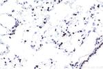 SMARCA4 Antibody in Immunohistochemistry (Paraffin) (IHC (P))