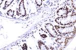 SMARCA4 Antibody in Immunohistochemistry (Paraffin) (IHC (P))