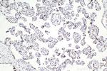 SMARCA4 Antibody in Immunohistochemistry (Paraffin) (IHC (P))
