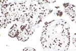 SMARCA4 Antibody in Immunohistochemistry (Paraffin) (IHC (P))