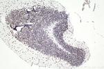 SMARCA4 Antibody in Immunohistochemistry (Paraffin) (IHC (P))
