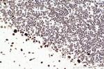 SMARCA4 Antibody in Immunohistochemistry (Paraffin) (IHC (P))