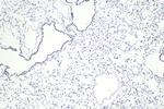 SMARCA4 Antibody in Immunohistochemistry (Paraffin) (IHC (P))