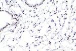 SMARCA4 Antibody in Immunohistochemistry (Paraffin) (IHC (P))