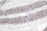 SMARCA4 Antibody in Immunohistochemistry (Paraffin) (IHC (P))