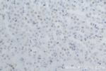 SMARCA4 Antibody in Immunohistochemistry (Paraffin) (IHC (P))