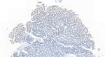 SMARCA4 Antibody in Immunohistochemistry (Paraffin) (IHC (P))