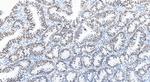 SMARCA4 Antibody in Immunohistochemistry (Paraffin) (IHC (P))