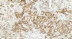 COPS8 Antibody in Immunohistochemistry (Paraffin) (IHC (P))