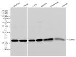 COPS8 Antibody in Western Blot (WB)