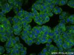 BRAP Antibody in Immunocytochemistry (ICC/IF)