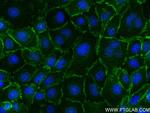 ADRB2 Antibody in Immunocytochemistry (ICC/IF)