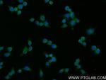 SAT1 Antibody in Immunocytochemistry (ICC/IF)