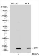 SAT1 Antibody in Western Blot (WB)