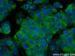 NRG1, isoform SMDF Antibody in Immunocytochemistry (ICC/IF)