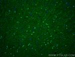 NRG1, isoform SMDF Antibody in Immunohistochemistry (PFA fixed) (IHC (PFA))