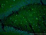 NRG1, isoform SMDF Antibody in Immunohistochemistry (PFA fixed) (IHC (PFA))