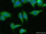RPS18 Antibody in Immunocytochemistry (ICC/IF)