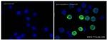Phospho-SYK (Tyr323) Antibody in Immunocytochemistry (ICC/IF)