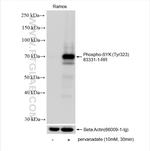 Phospho-SYK (Tyr323) Antibody in Western Blot (WB)